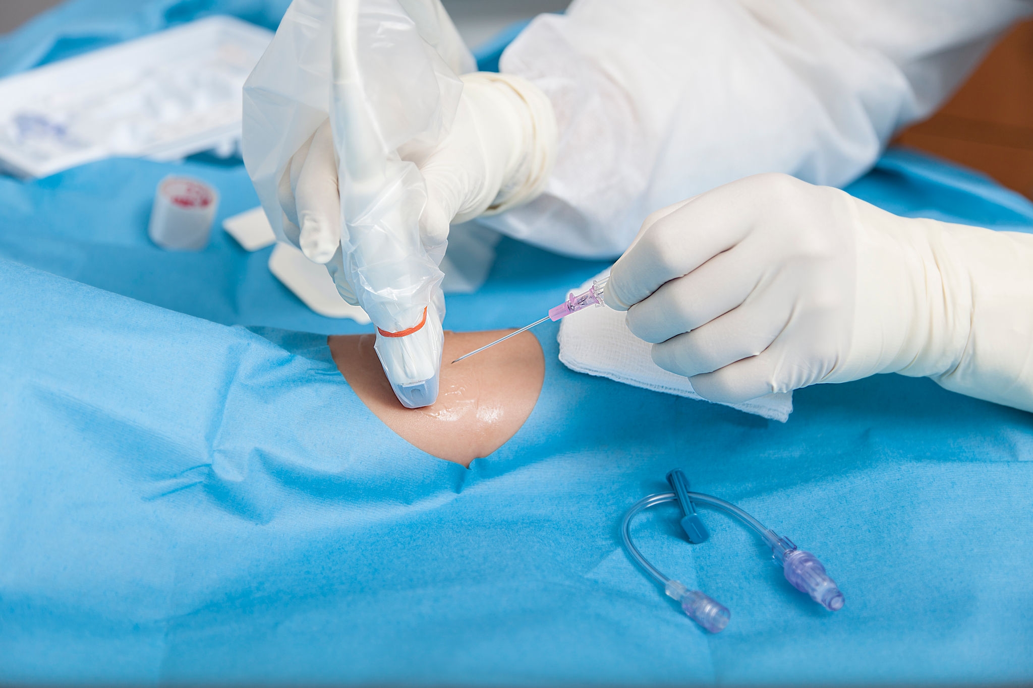 Clinician inserting the Introcan Safety Deep Access IV Catheter with ultrasound into a patient’s arm with gloves and sterile drape visible, highlighting deep vein access.