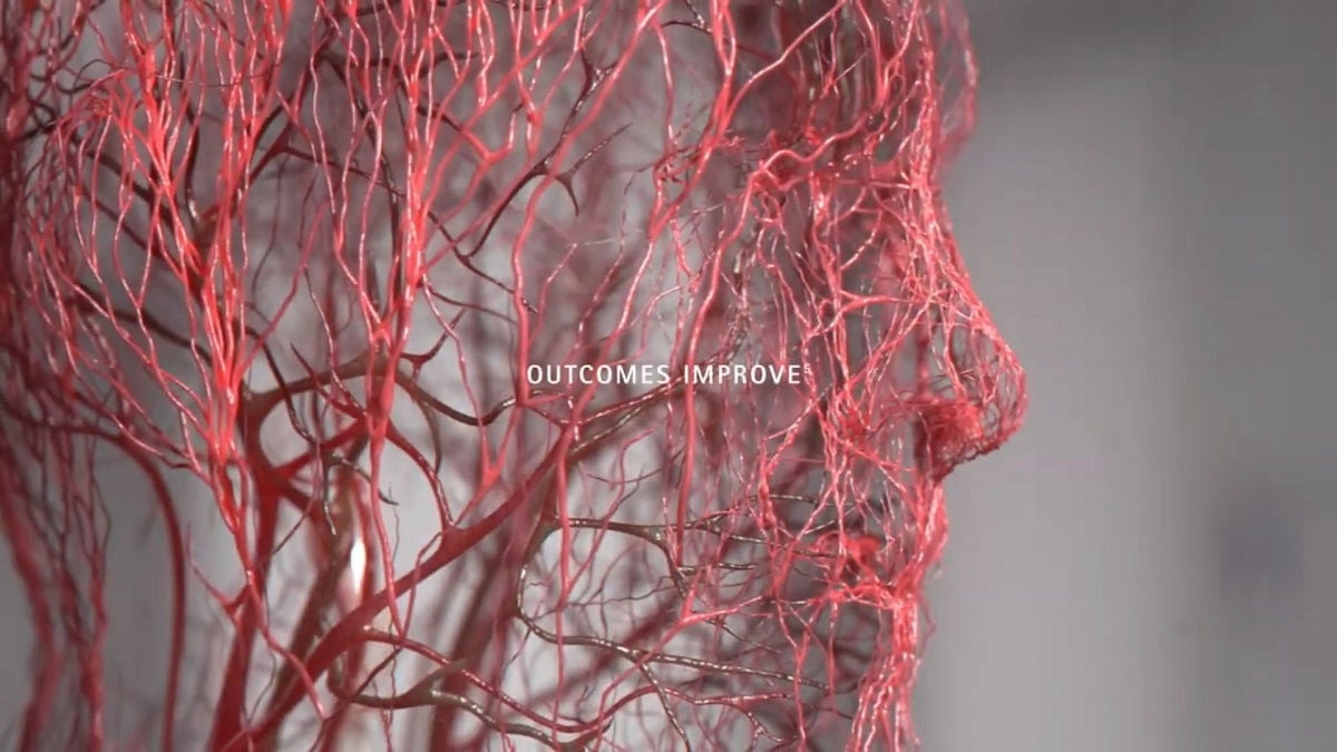 A close up of the face of a human made out of veins.
