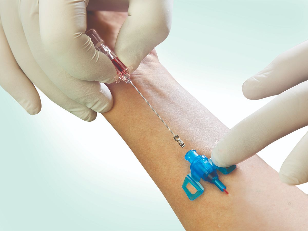 Close-up of Introcan Safety 3 Catheter being inserted by a gloved hand into an arm. 