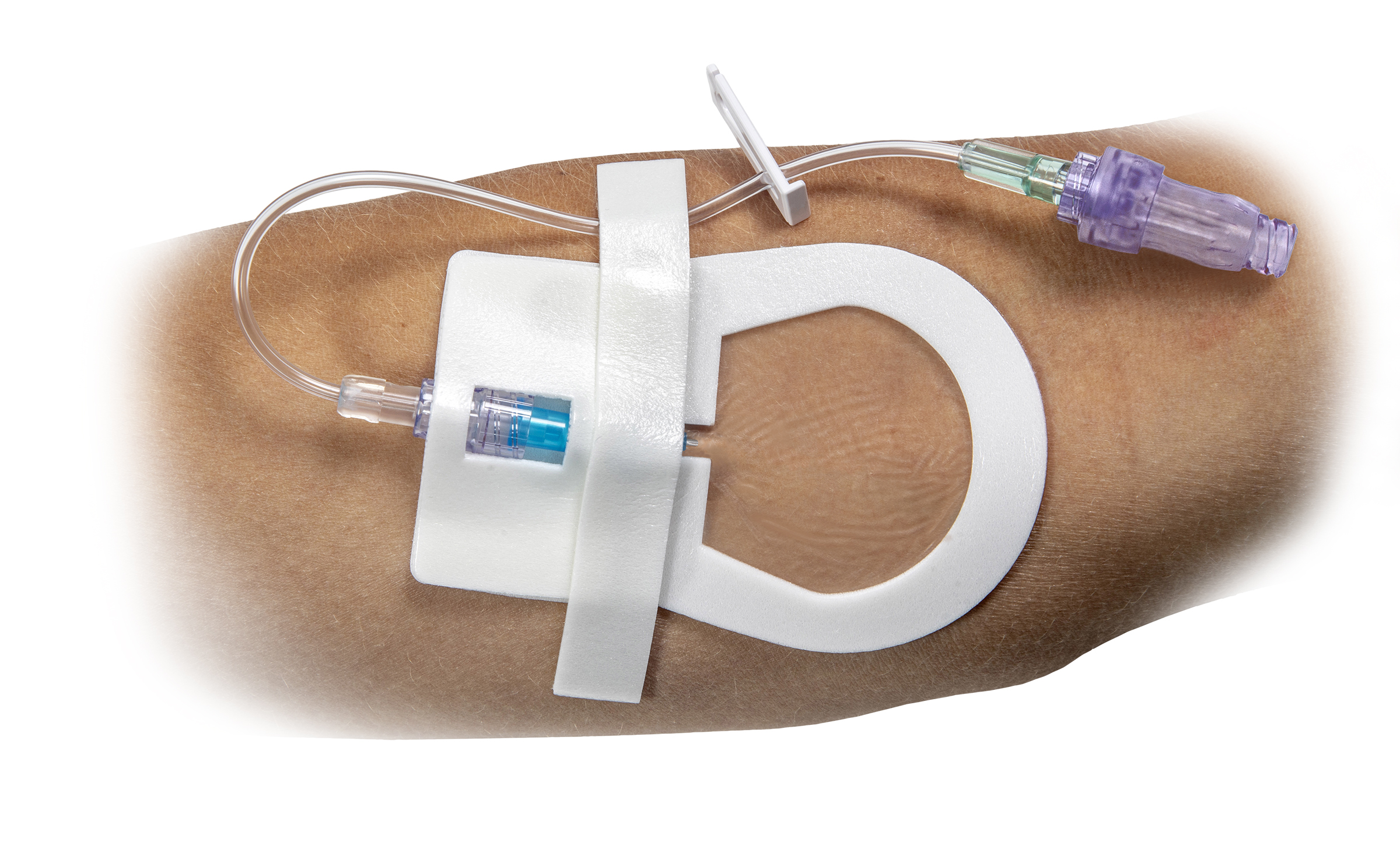 A close-up of the Clik-FIX Peripheral Catheter Securement Device placed on an arm.