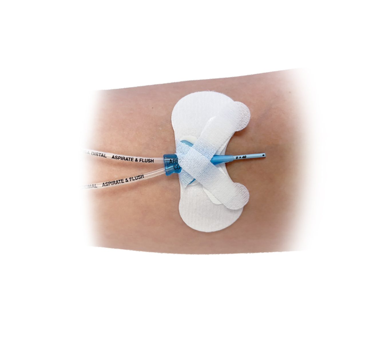 Close-up of the Clik-FIX Soft PICC/Central Securement Device on a section of a patient's arm. 