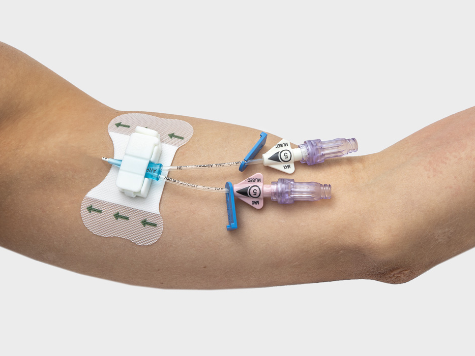 Close-up of the Clik-FIX PICC/Central Tricot Catheter Securement Device inserted in the upper part of an adult arm.