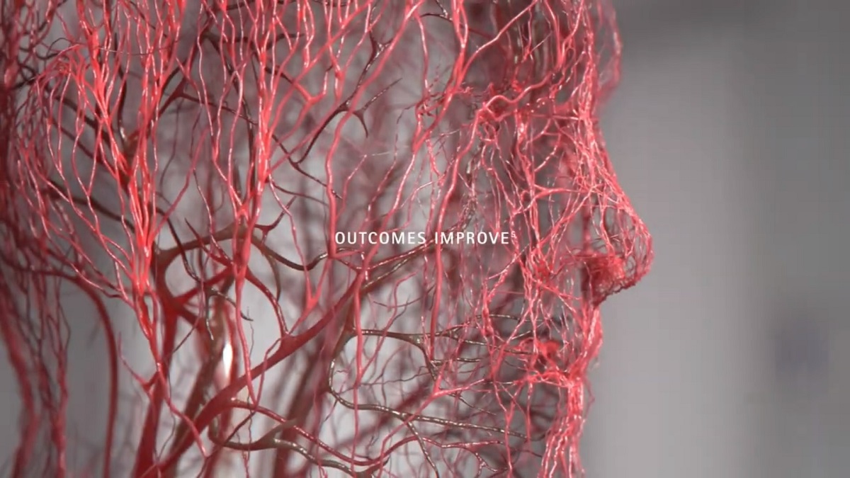 A close up of the face of a human made out of veins.