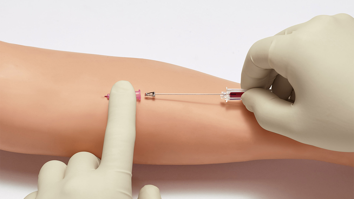 Introcan Safety 2 IV Catheter showcasing passive safety technology during an insertion that is being done by two gloved hands on a patient's arm.